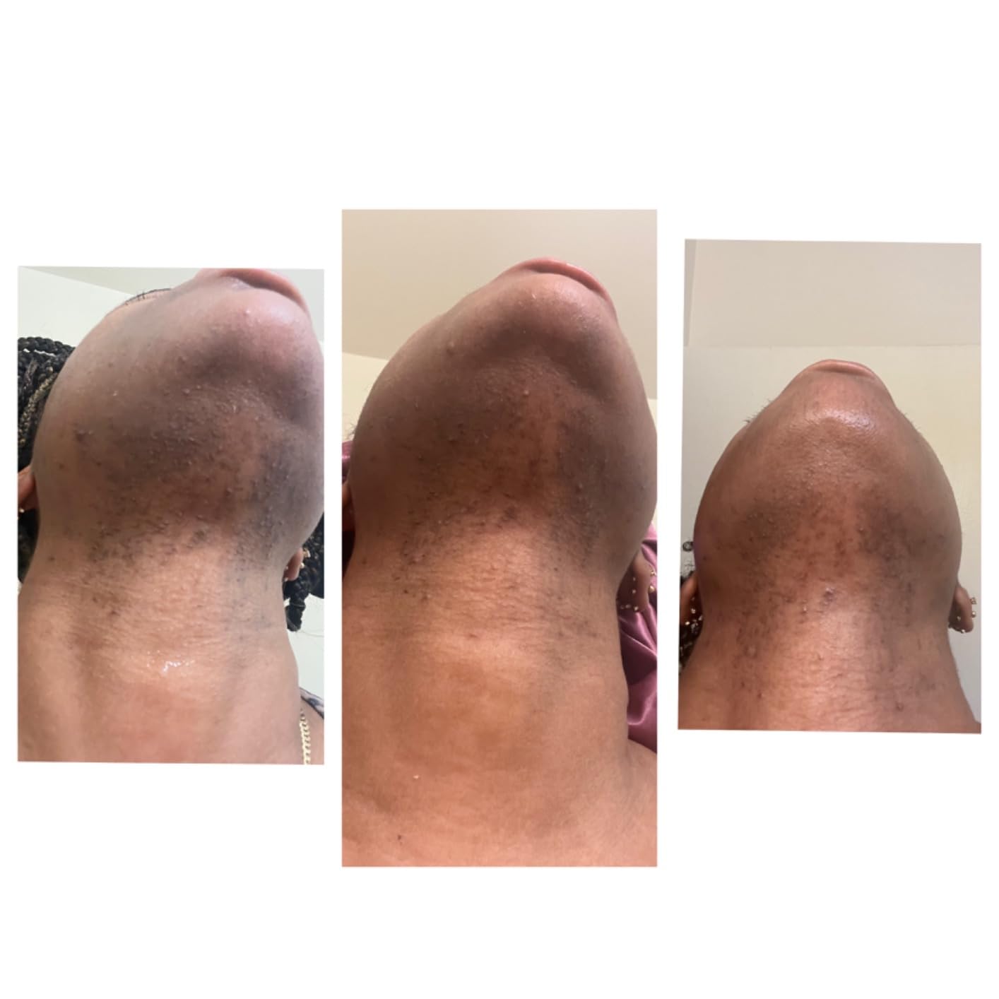 Lunira™ Smoothing Serum