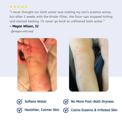 Lunira™ Bathtub Filter Replacement