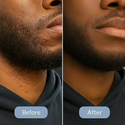 Lunira™ Roll-On Smoothing Serum